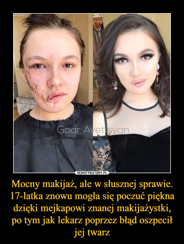 Mocny makijaż, ale w słusznej sprawie. 17-latka znowu mogła się poczuć piękna dzięki mejkapowi znanej makijażystki, po tym jak lekarz poprzez błąd oszpecił jej twarz –  