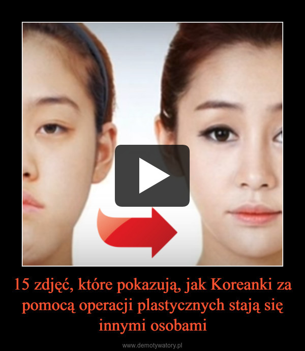 15 zdjęć, które pokazują, jak Koreanki za pomocą operacji plastycznych stają się innymi osobami –  