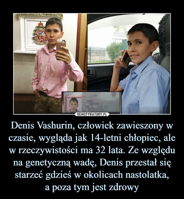 Denis Vashurin, człowiek zawieszony w czasie, wygląda jak 14-letni chłopiec, ale w rzeczywistości ma 32 lata. Ze względu na genetyczną wadę, Denis przestał się starzeć gdzieś w okolicach nastolatka,a poza tym jest zdrowy –  