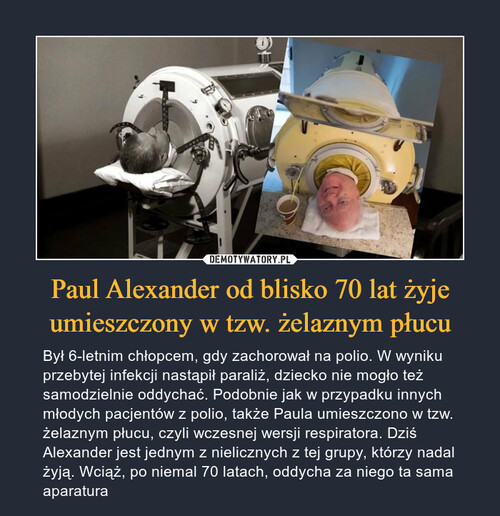 Paul Alexander od blisko 70 lat żyje umieszczony w tzw. żelaznym płucu